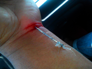 fishing-accident